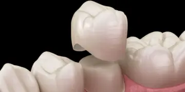 When to Choose a Dental Crown vs Filling