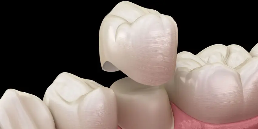 When to Choose a Dental Crown vs Filling