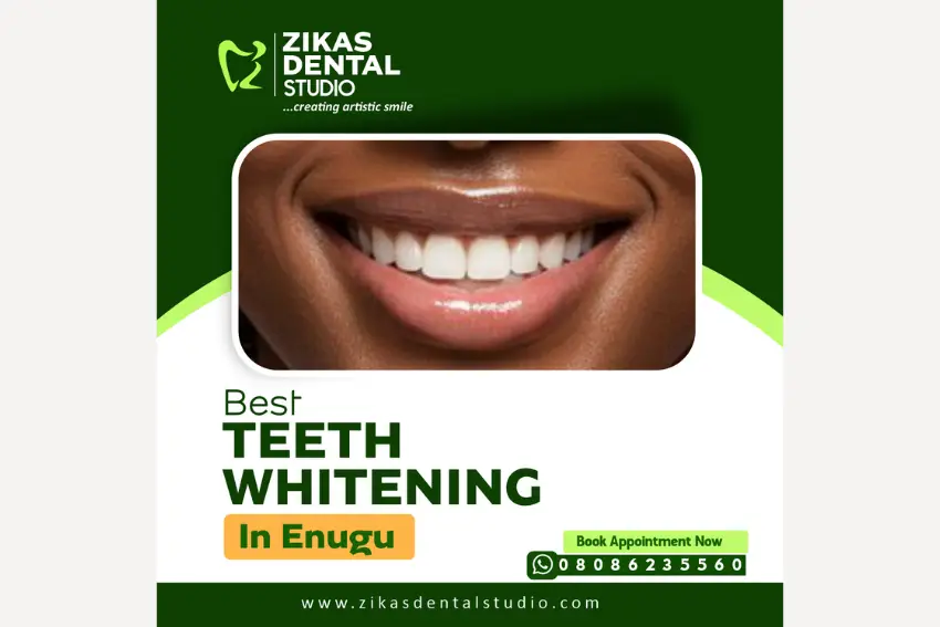 Teeth whitening clinic Kubwa Abuja