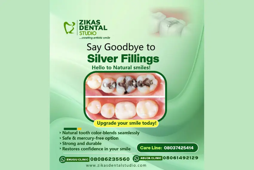 Composite Veneers dentist in Enugu